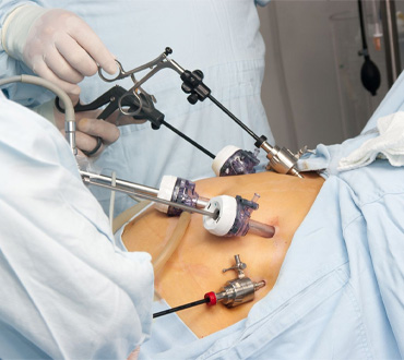 Best Robotic Surgery in Delhi